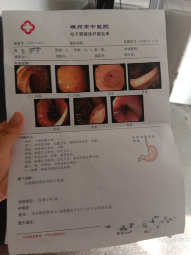 胆汁反流的症状有哪些