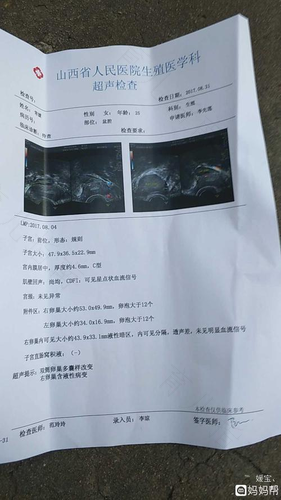 巧囊会引起宫腔粘连吗 巧囊会引起宫腔粘连吗