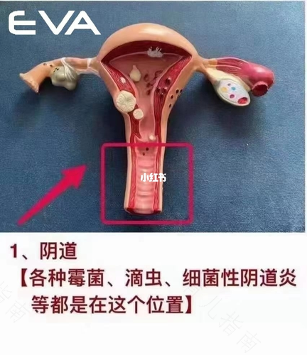 宫颈口痛是怎么回事儿 宫颈口痛是怎么回事儿