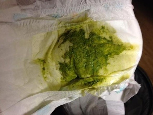 宝宝大便是绿色的怎么办