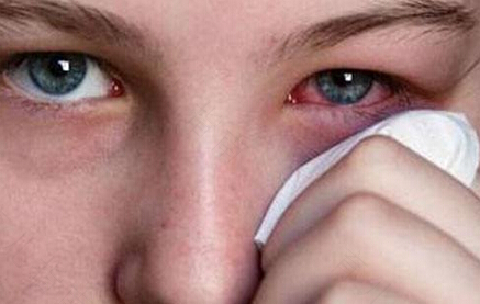 春季眼睛痒怎么办越揉越痒 春季眼睛痒怎么办越揉越痒