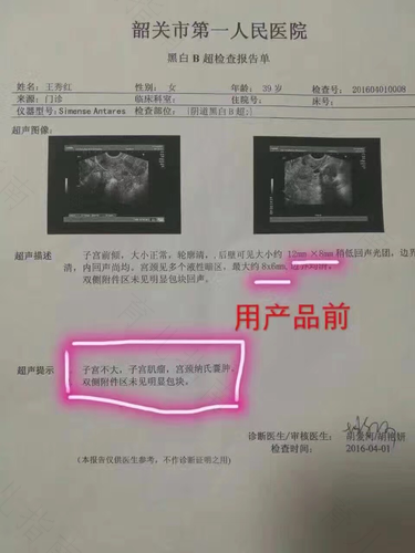 宫颈囊肿有点痛怎么办? 宫颈囊肿有点痛怎么办?