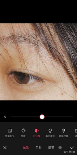 眼睛周围红点怎么回事? 眼睛周围红点怎么回事?