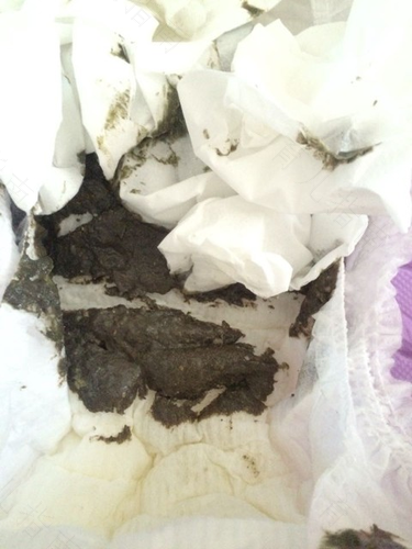 最近大便黑黑的怎么回事