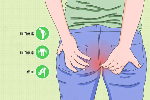 肛周瘙痒是怎么引起的 肛周瘙痒是怎么引起的
