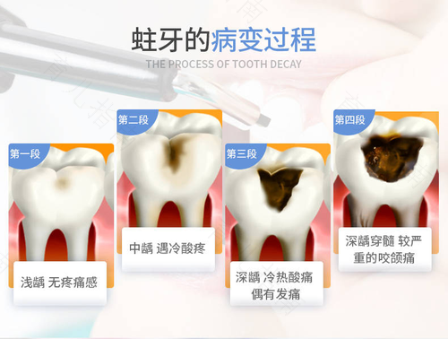 大牙有个洞很疼怎么办需要拔掉吗 大牙有个洞很疼怎么办需要拔掉吗