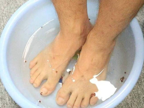 脚痒用盐水泡有用吗 脚痒用盐水泡有用吗