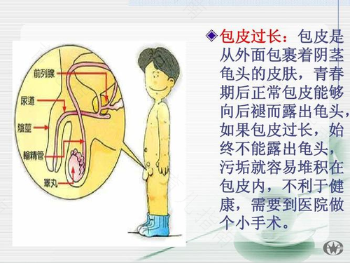 阴囊污垢多怎么回事 阴囊污垢多怎么回事