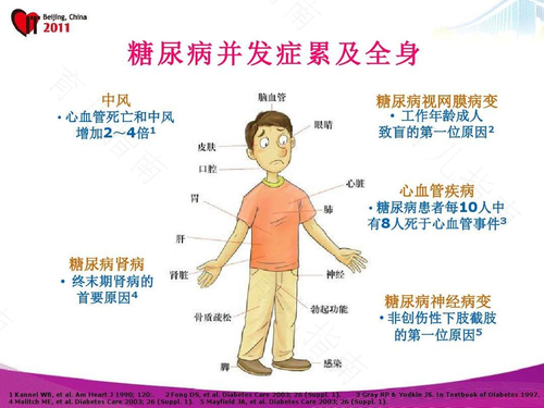 糖尿病并发症严重吗? 糖尿病并发症严重吗?