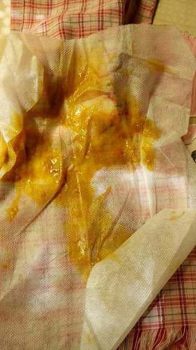 经常拉稀一天好几次怎么办