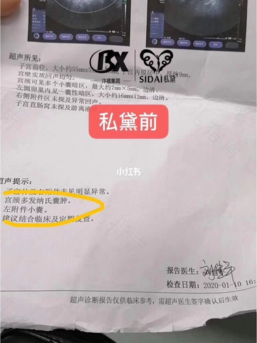 宫颈纳囊是多囊卵巢吗 宫颈纳囊是多囊卵巢吗