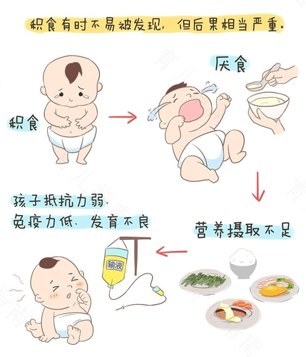 胃积食怎么办快速解决 胃积食怎么办快速解决