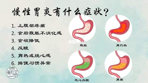 慢性胃炎会有什么症状 慢性胃炎会有什么症状
