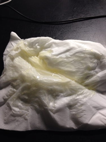 精子不液化会怀孕吗? 精子不液化会怀孕吗?