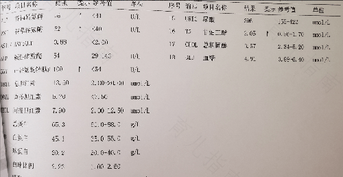 乙肝大三阳同房传染吗 乙肝大三阳同房传染吗