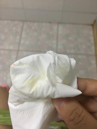 水样脓性白带是怎么回事呢 水样脓性白带是怎么回事呢