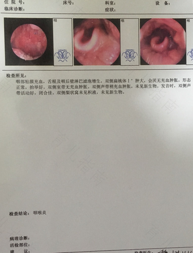 咳嗽总是有白痰怎么办