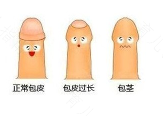 刚做完包茎手术能走吗 刚做完包茎手术能走吗