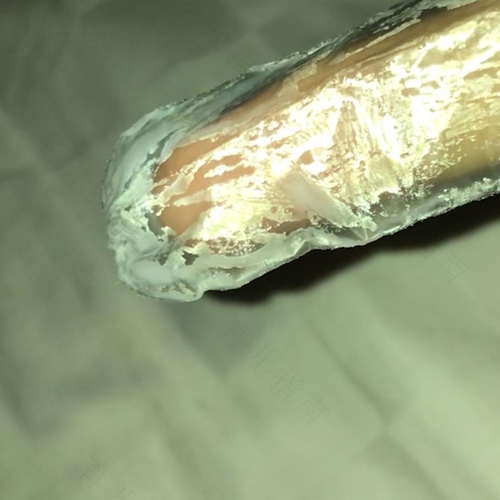 白带是乳白色是怎么回事 白带是乳白色是怎么回事