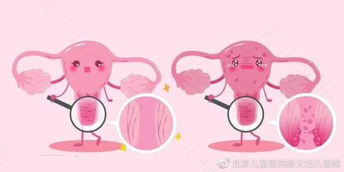 外阴溃疡很严重怎么办 外阴溃疡很严重怎么办