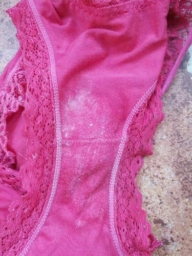 白带有少量淡粉色是怎么回事 白带有少量淡粉色是怎么回事