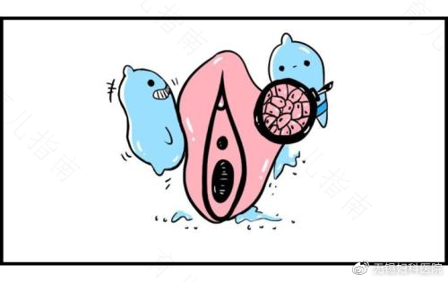 外阴病变是什么原因引起的 外阴病变是什么原因引起的