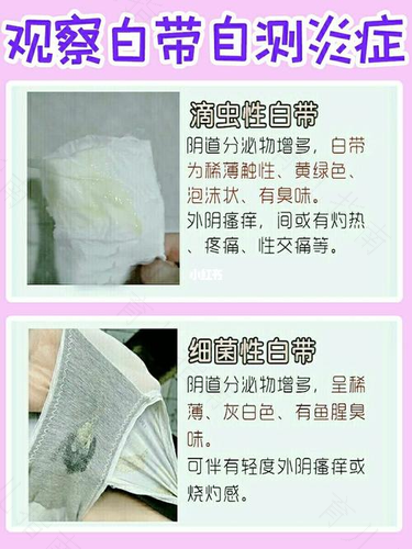 附件炎怎么查出来
