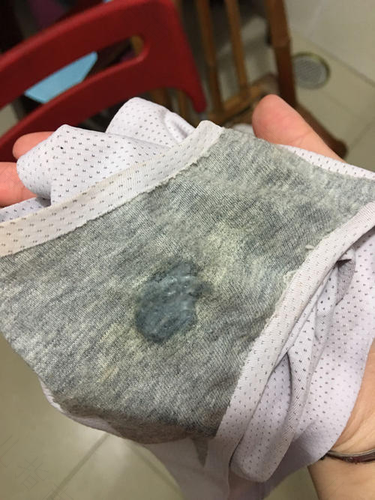 白带多粘稠是怎么回事 白带多粘稠是怎么回事