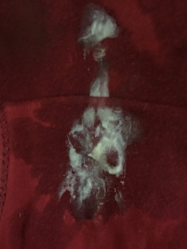 为什么白带有酸酸的味道