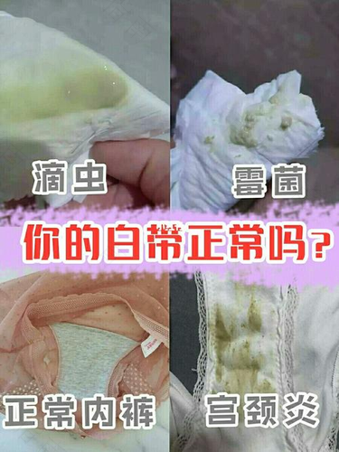 白带很臭什么原因但是很白 白带很臭什么原因但是很白