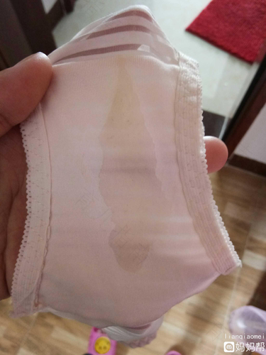 水样白带用什么药 水样白带用什么药