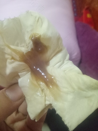 女生白带发黑是什么原因 女生白带发黑是什么原因