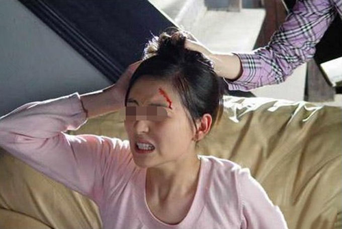 妈妈扇孩子耳光危害