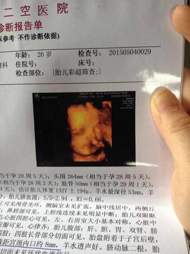 怀孕36周胎盘增厚是什么原因 怀孕36周胎盘增厚是什么原因