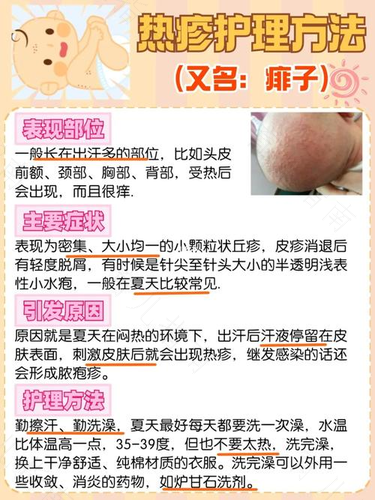 尿布，宝宝的第二层皮肤