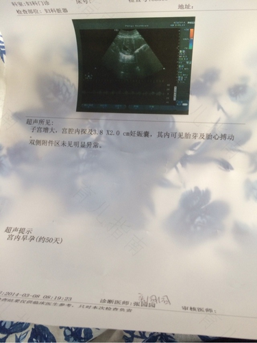 为什么胎心胎芽有的早有的晚