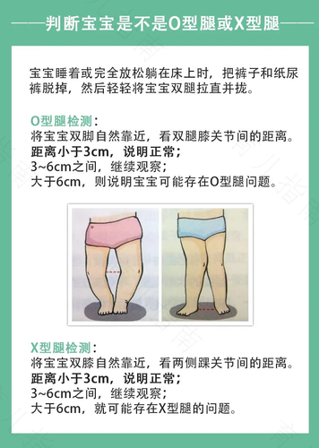 助力腿部发育 BB走路更稳