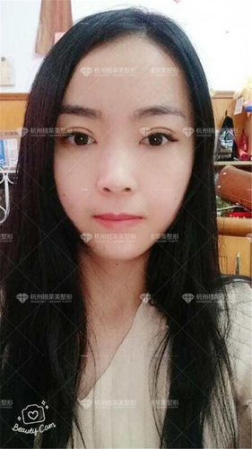 孕期吃什么宝宝头发多眉毛浓眼睛大 孕期吃什么宝宝头发多眉毛浓眼睛大