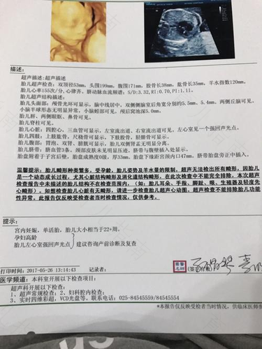 超声估测胎儿体重3985±582有多重