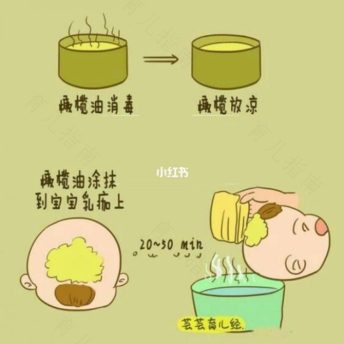 新生宝宝，要加倍呵护