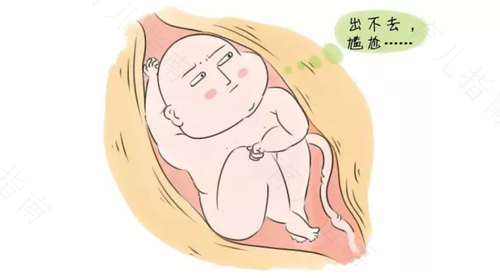 弥补剖宫产儿的心理缺欠