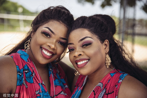 美国的连体双胞胎