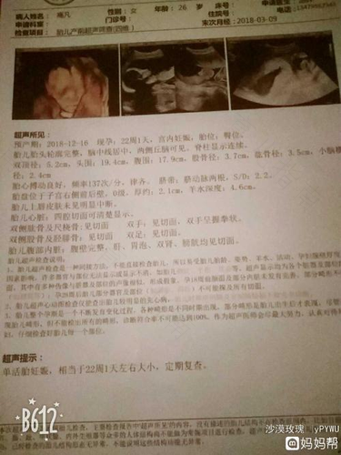 肚里有了“小马仔” 准爸准妈忙起来