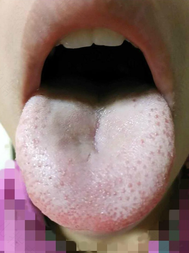 宝宝积食有口气该怎么办 宝宝积食有口气该怎么办