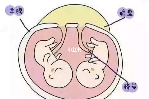 818双胞胎如何形成？