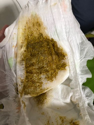 宝宝便后四步走 新手宝妈知道否