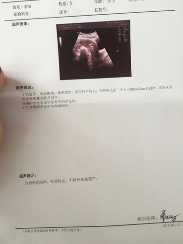 不小心中彩 人流可致不孕 不小心中彩 人流可致不孕