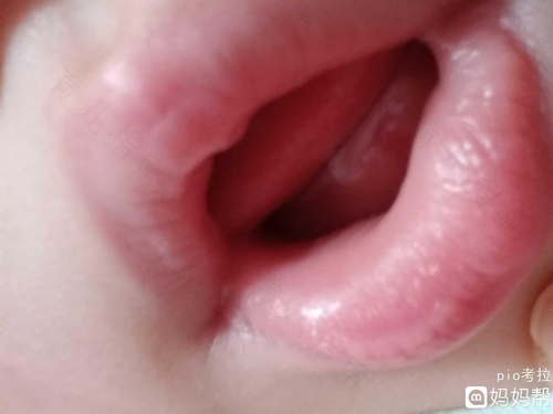 九个月宝宝长一颗牙正常吗 九个月宝宝长一颗牙正常吗