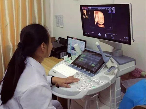 四维彩超做完需要让医生看吗