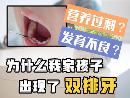 幼儿双排牙的原因